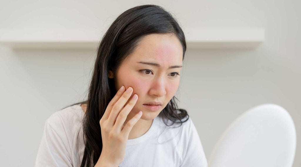 What is the Differences Between Acne & Rosacea?