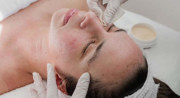 Advanced QPro Peels Certification Training for professional aestheticians